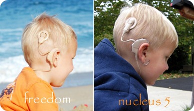 cochlear processors side by side