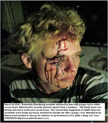 [Robindale youth attacked by panga March 242010 Eblockwatch[5].jpg]