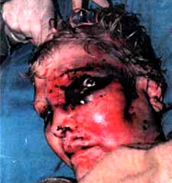 [AfrikaansFarmWifeMurderedInBedPoliceForensicExaminationPic[3].jpg]
