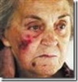 Judith_Steenkamp_86_Kameeldrift Survived Attack