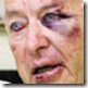 Oudtshoorn van Donna after attack by 3 bikers Sterkfontein caves March 14 2009