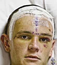[Jackson Craig 17 beaten up by 5 youths Bronhorstspruitdam July42009[5].jpg]