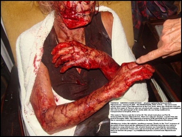 [Viljoenskroon farm attack victim panga injuries THERESA - Jan 25 2010 ATTACK pic Carien Somers Dippenaar Facebook_thumb[4][8].jpg]