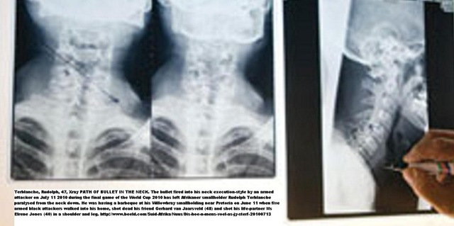 [TerblancheRudolphParalysedByBulletNeckWillowbray_XRAY_PretoriaJuly132010[6].jpg]