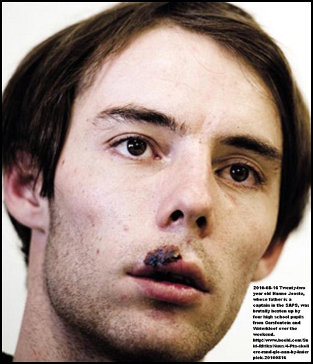 Jooste Hanno 22 son of SAPS CAPT BEATEN BY 4 PUPILS AUG162010