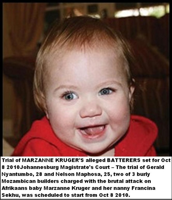 Kruger Marzanne 1 brutally bashed by 3 Mozambiquans 22 April 2010 recovering sight
