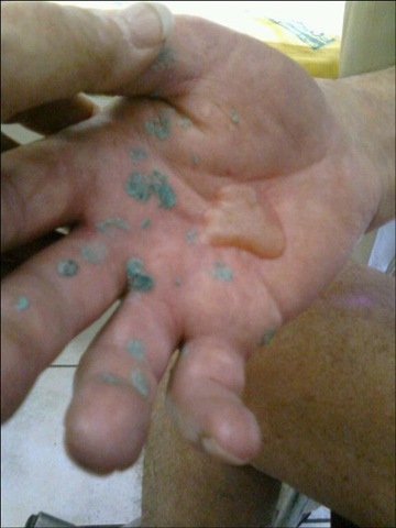 [TORTURE during SA violent crime white victims often burnt with melting plastic[5].jpg]