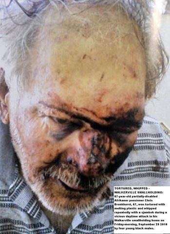 [Bronkhorst Chris disabled Walkerville man tortured melt plastic and sjambok Sept292010 4 blacks[8].jpg]