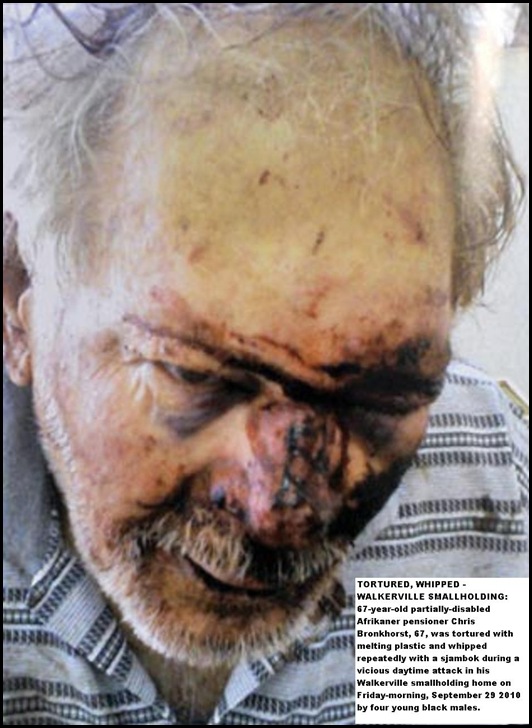 Bronkhorst Chris disabled Walkerville man tortured melt plastic and sjambok Sept292010 4 blacks