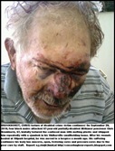 Bronkhorst Chris after vicious attack before  hospitalisation