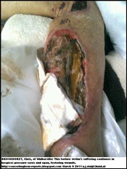 Bronkhorst Chris attack victim maltreatment in hospice