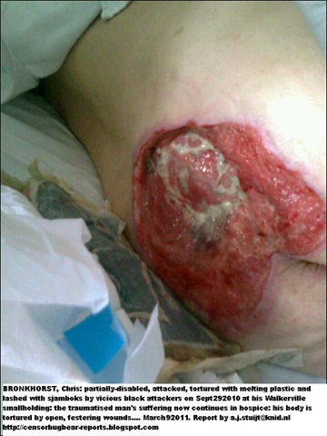 [Bronkhorst Chris attack victim maltreatment in hospice infected sores[6].jpg]