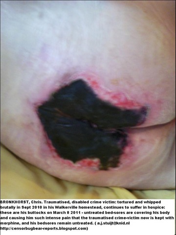 [BRONKHORST Chris pressure sores caused by neglect hospice attack victim dies Apr242011[6].jpg]