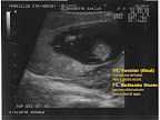 echo15aout_11.jpg