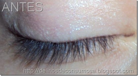 ANTES ALONGAMENTO