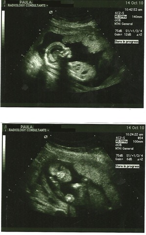 10-14-10 ultrasound