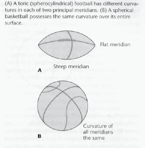 Astigmatism