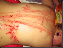 skincarve