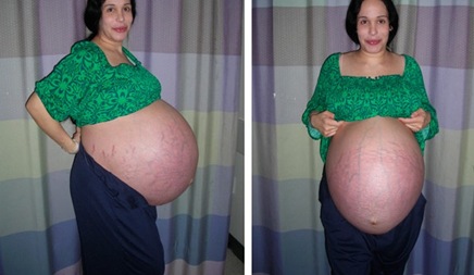 nadya-suleman