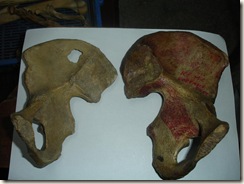 left female hip bone,right male hip bone
