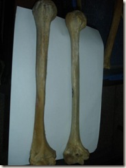left male humerus &  right humerus (female) with hole in trochlea
