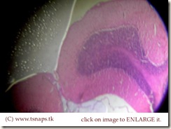 Cerebellum histology slide