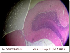 Cerebellum histology slide Cerebellum histology slide