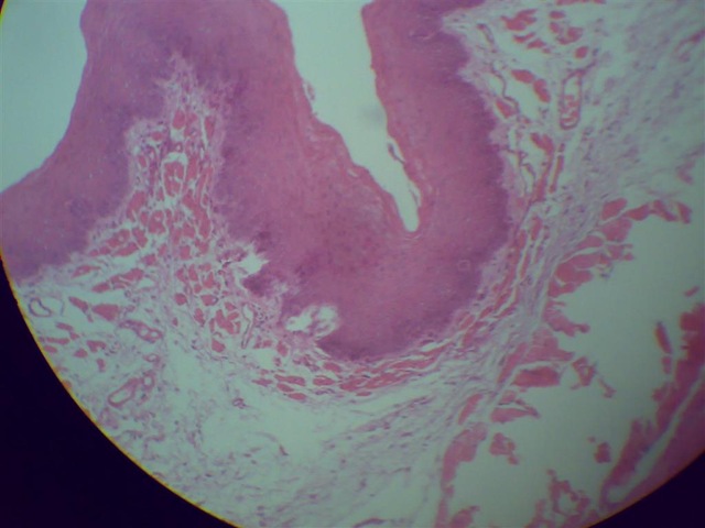 [Stratified squamous epithelium under microscope[2].jpg]