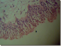 Transitional epithilium under microscope