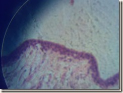 Stratified columnar epithelium under microscope_thumb
