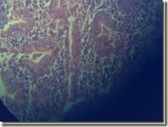 Purkinje cells 2 histology slide_thumb