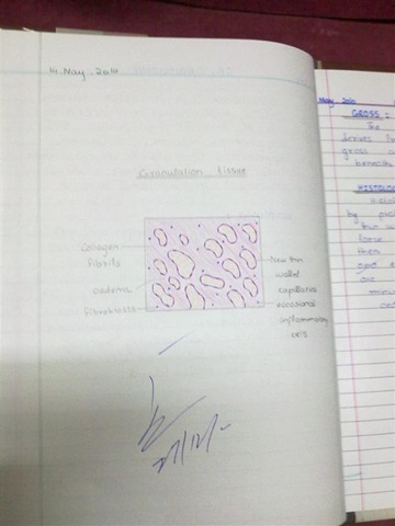 [granulation tissue diagram H&E[2].jpg]