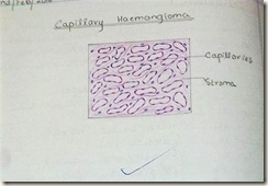 capillary hemangioma H&E diagram