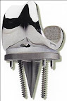 Click to Expand Titanium medical parts