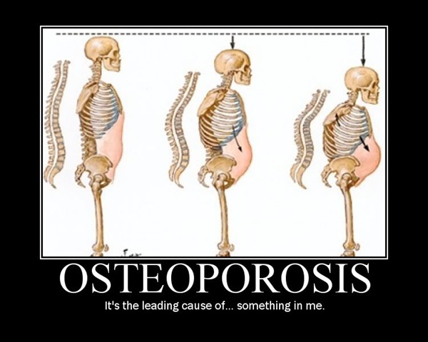 [osteoporosis[5].jpg]