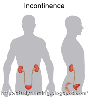 [incontinence[5].gif]