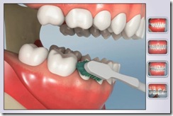 higiene oral