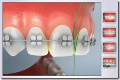 higiene oral