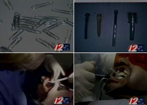 endodontia