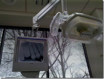 na cadeira dentista 1
