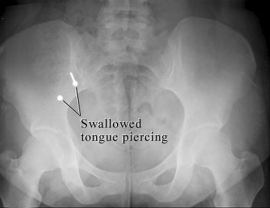 [piercing[4].jpg]