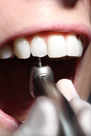 [broca do dentista[3].jpg]