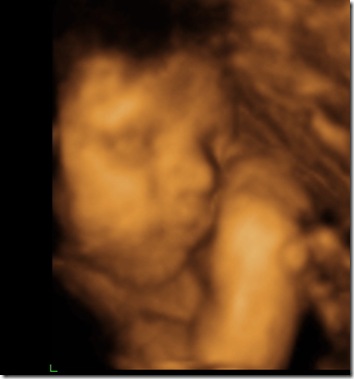 BABY BOY 4D PICS_2_10