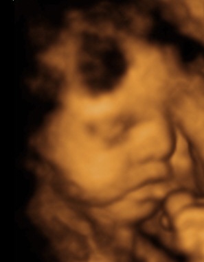 [BABY GIRL BELLA GRACE 4D PICS_43[5].jpg]