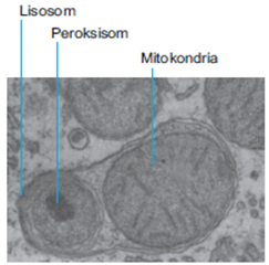 lisosom lisosom