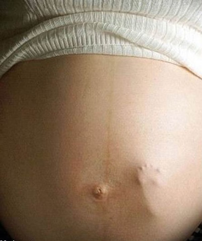 [embarazada con el pie del bebe en la panza[4].jpg]