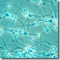 spermatozoi