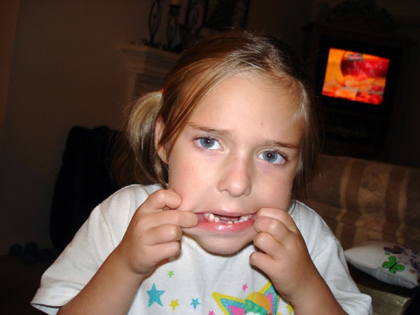 [TOOTH035.jpg]