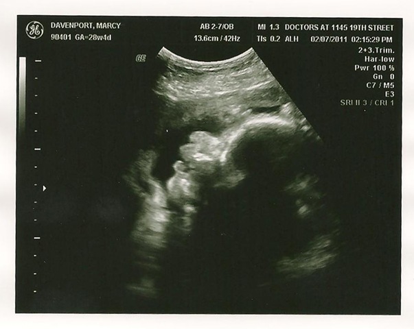 [baby 29 weeks 1[2].jpg]