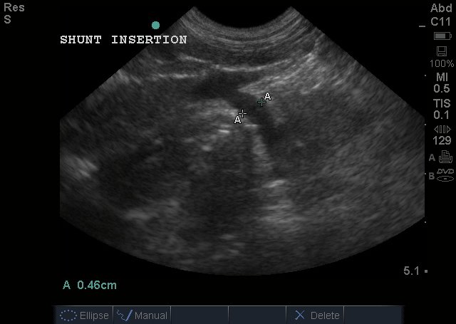 NVi – North East Veterinary Imaging Abdominal – Canine abdominal canine